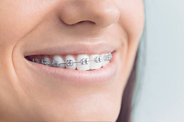 Laser Dentistry in Leonardtown, MD